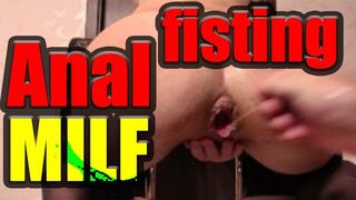 Ingyen nézheted, ahogy egy mocskos anál milf öklözik magát